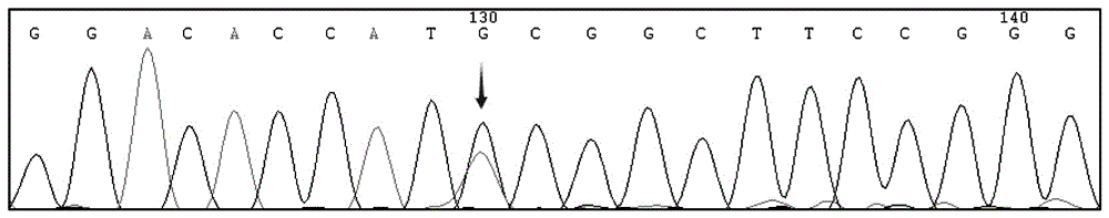 Human idiopathic basal ganglia calcification pathogenic gene and detection method thereof