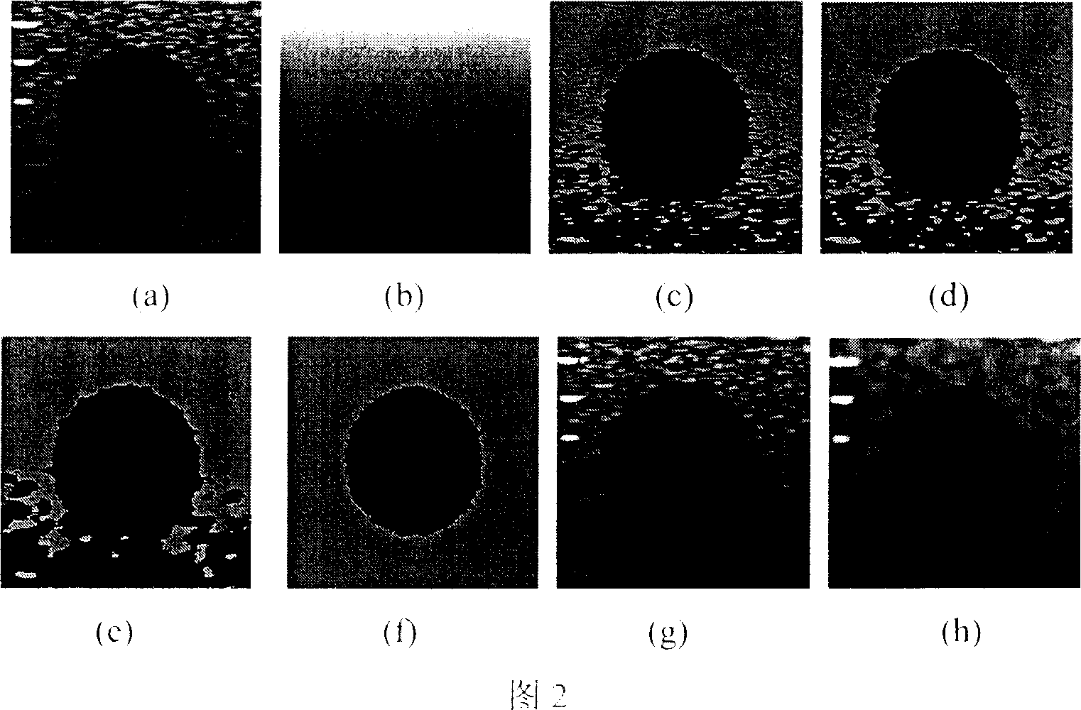 Two-dimensional blur polymer based ultrasonic image division method