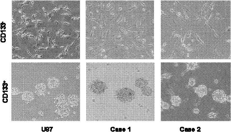 Application of miRNA-20a and its inhibitors in the preparation of glioma stem cell invasion regulators