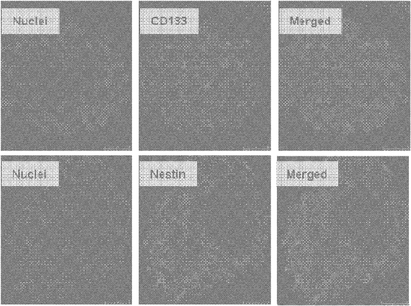 Application of miRNA-20a and its inhibitors in the preparation of glioma stem cell invasion regulators