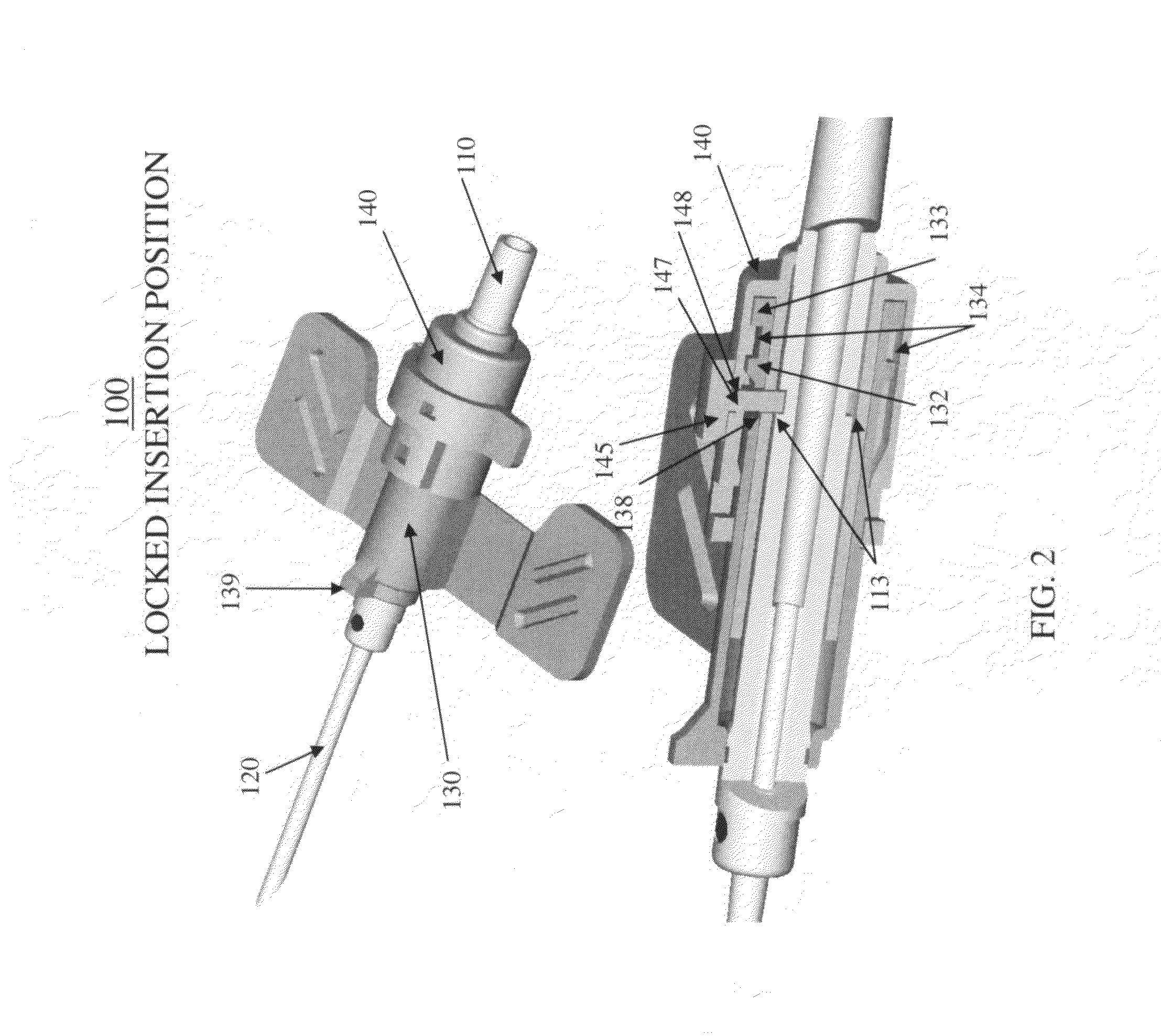 Telescopic safety arteriovenous fistula needle