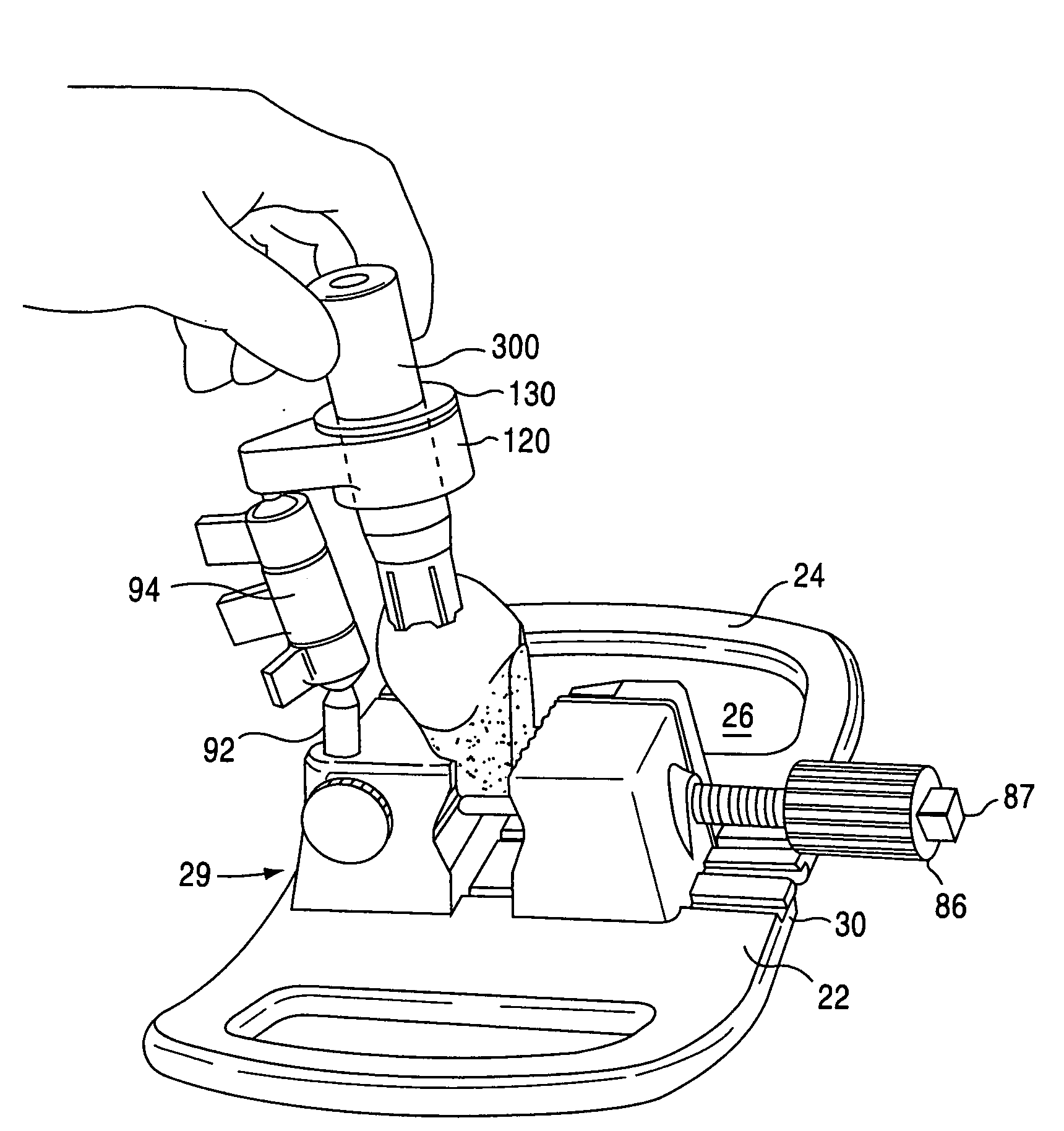 Osteochondral allograft cartilage transplant workstation