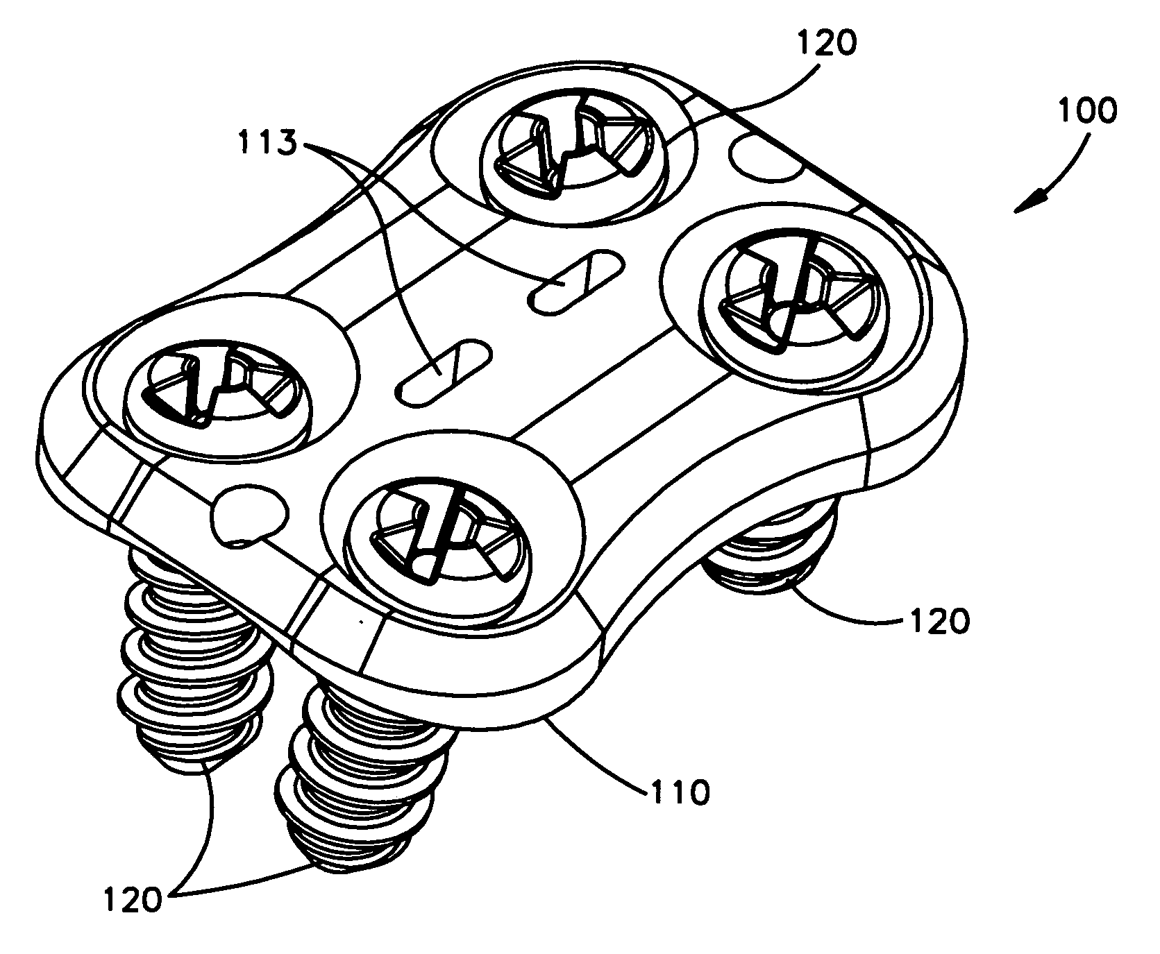 Resorbable anterior cervical plating system with screw retention mechanism