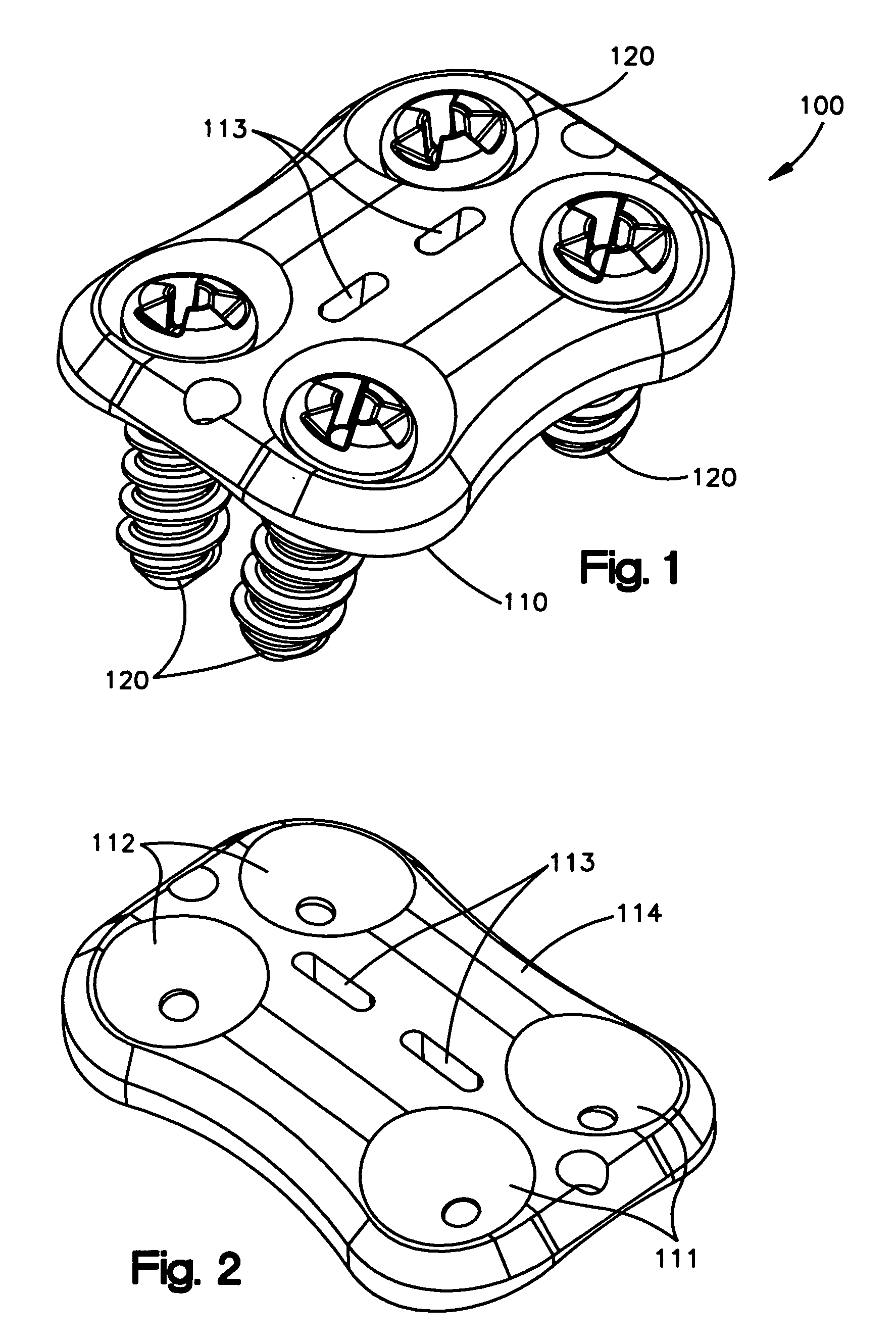 Resorbable anterior cervical plating system with screw retention mechanism