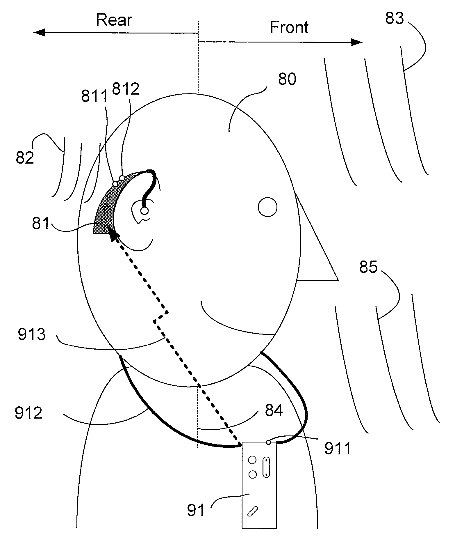 Listening device providing enhanced localization cues, its use and a method