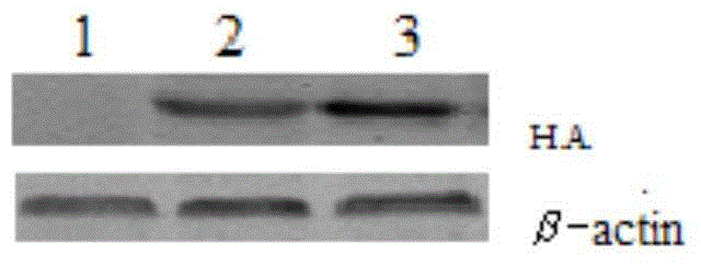 Application of hypodermin A in preparation of preparation for inhibiting immunological rejection in organ transplantation