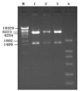 Porcine parvovirus recombinant pseudorabies virus genetic engineering live vector vaccine and preparation method thereof