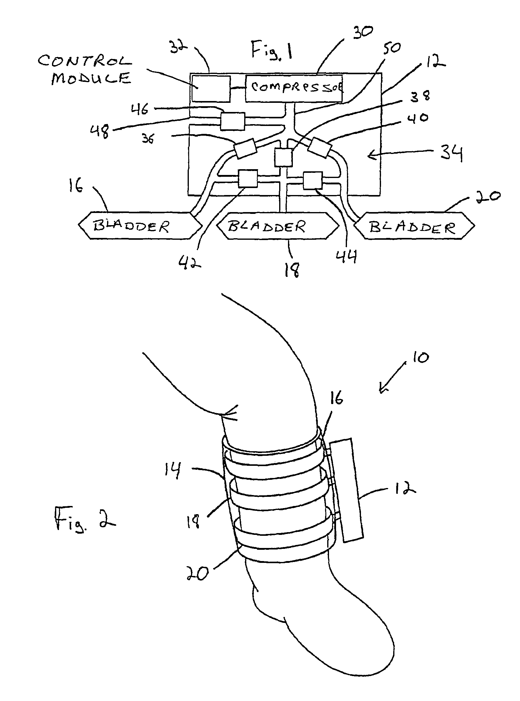 Blood clot prevention device