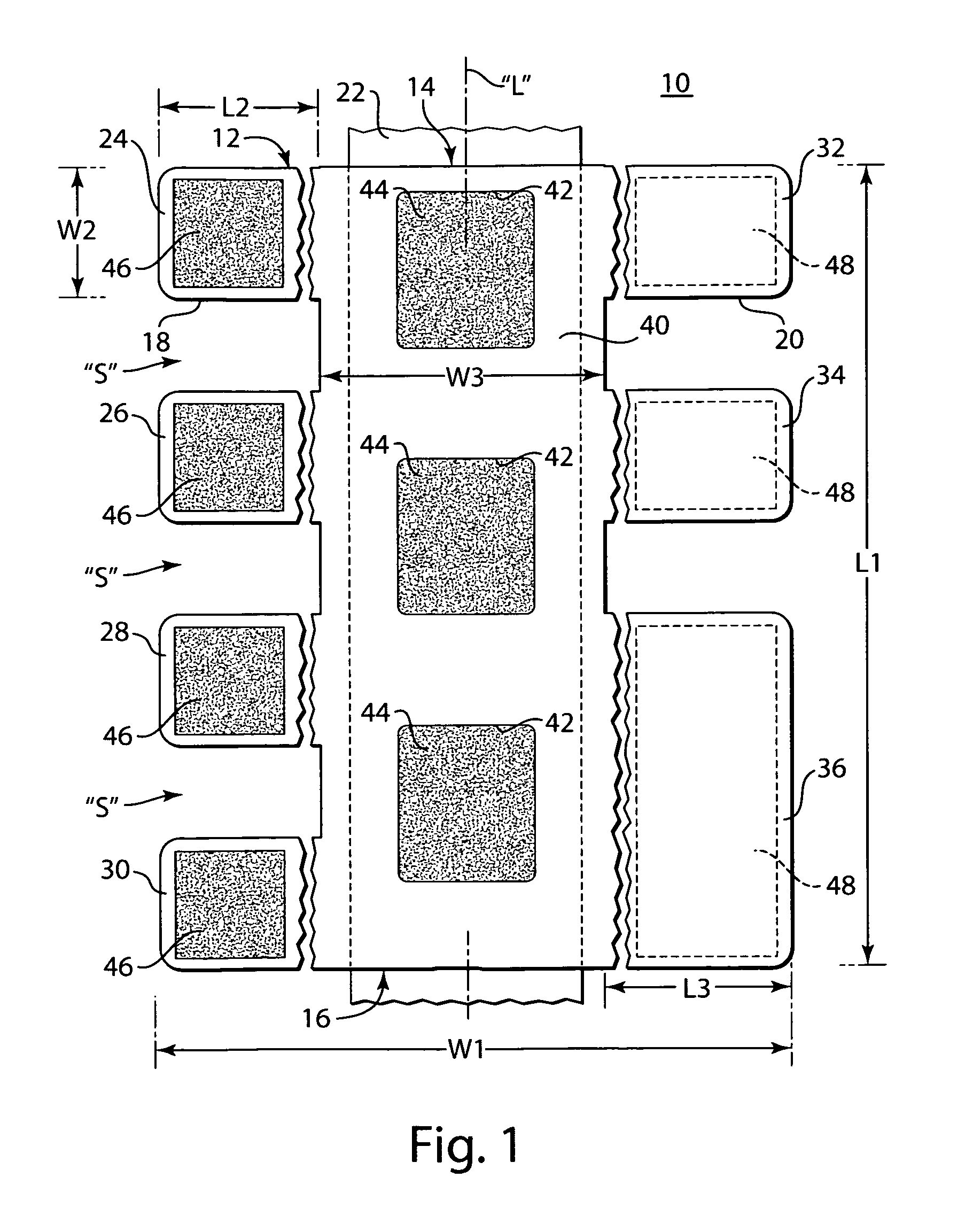 Arm board patient securement arrangement