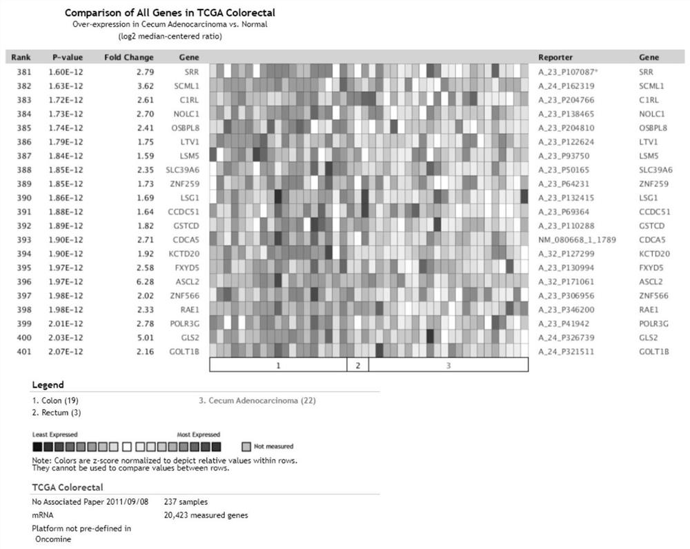 Application of GOLT1B inhibitor in preparation of medicine for treating colorectal cancer