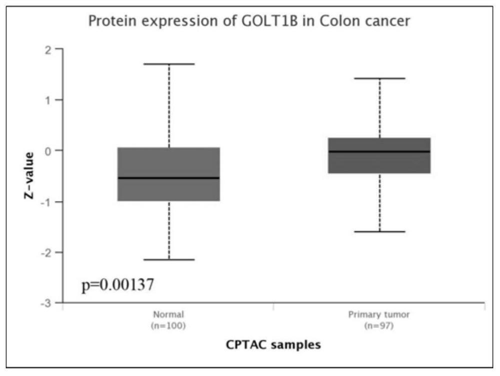 Application of GOLT1B inhibitor in preparation of medicine for treating colorectal cancer