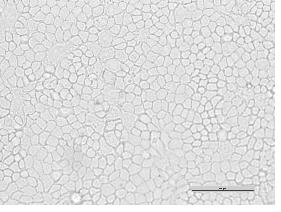 Method for marking canine kidney cells through chitosan-quantum dot fluorescent probe