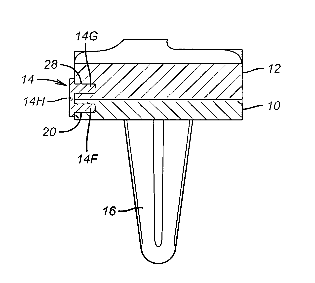 Rotating/non-rotating tibia base plate/insert system