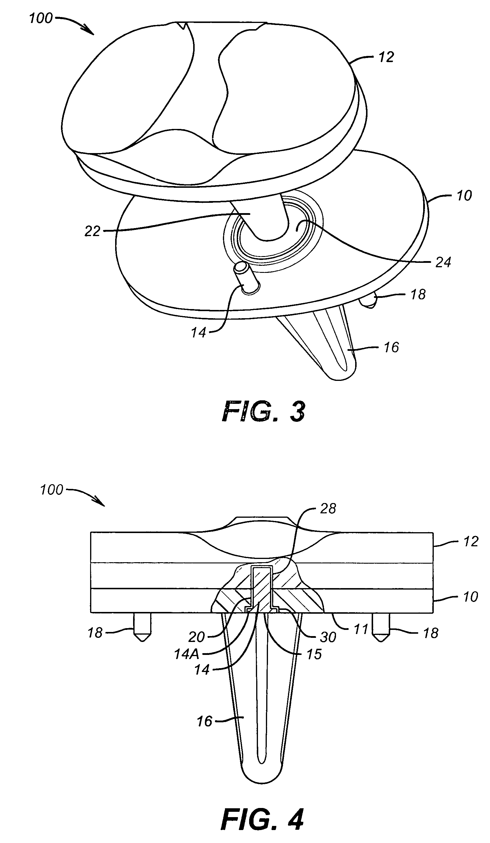 Rotating/non-rotating tibia base plate/insert system