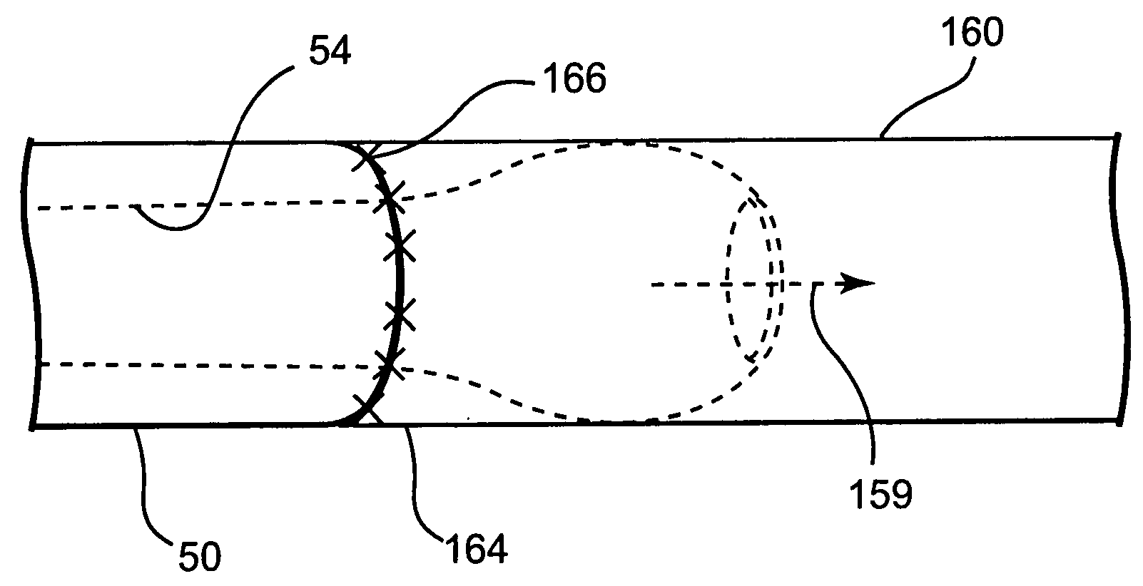 Transconduit perfusion catheter