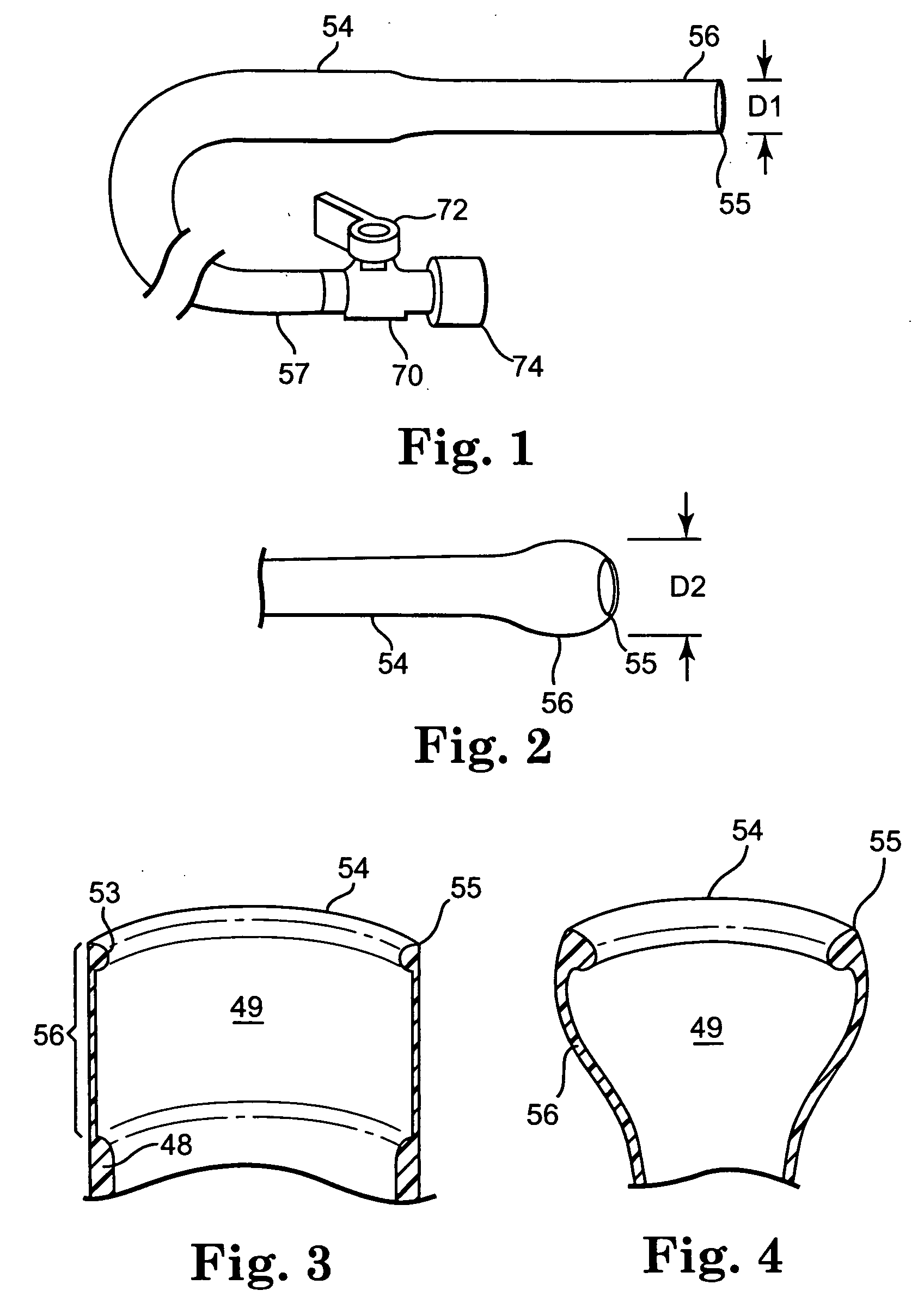 Transconduit perfusion catheter