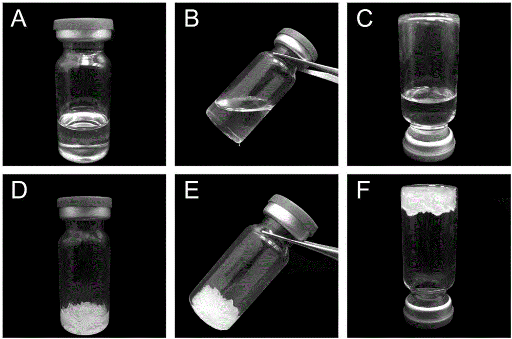 Cubic liquid crystal in-situ gel injection of local anesthetic, and preparation method of injection