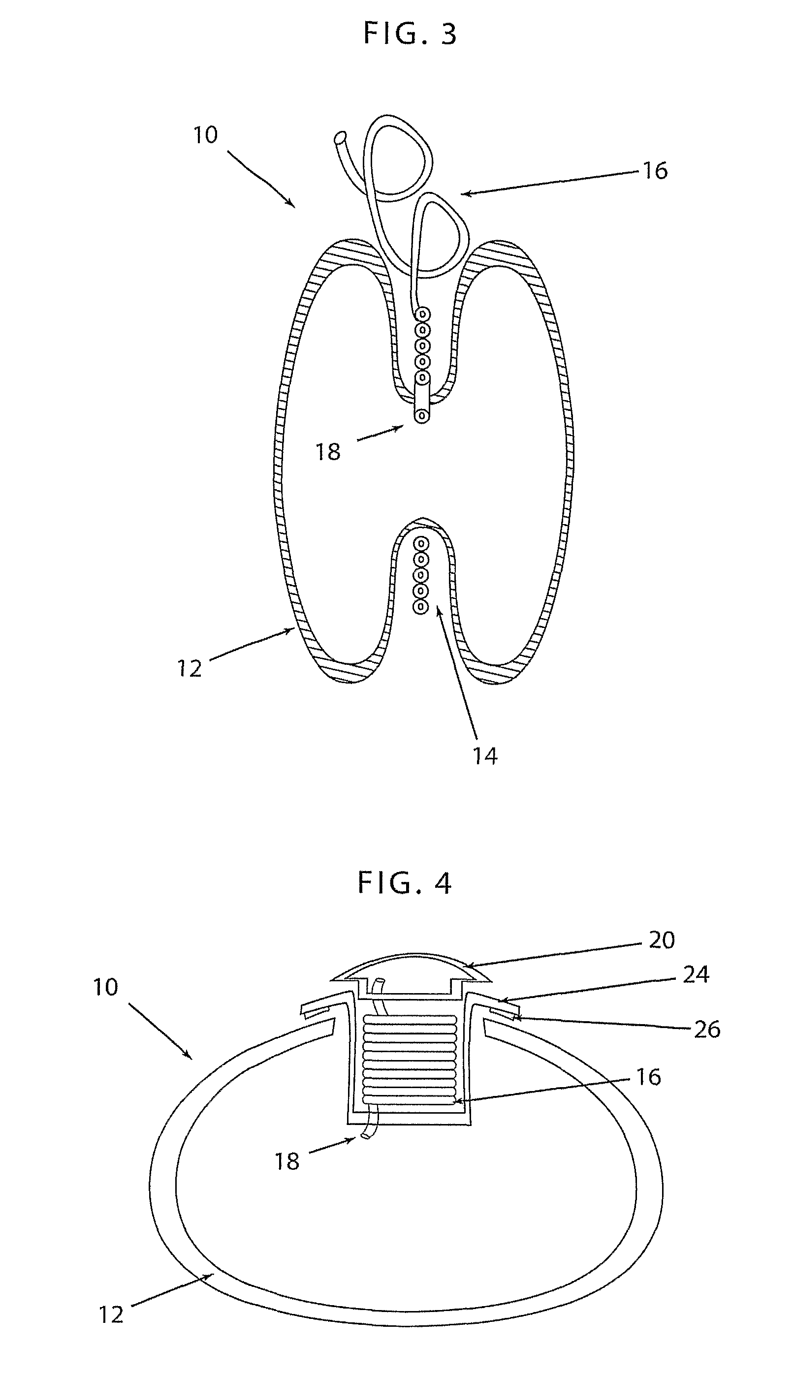 Apparatus and method for volume adjustment of intragastric balloons