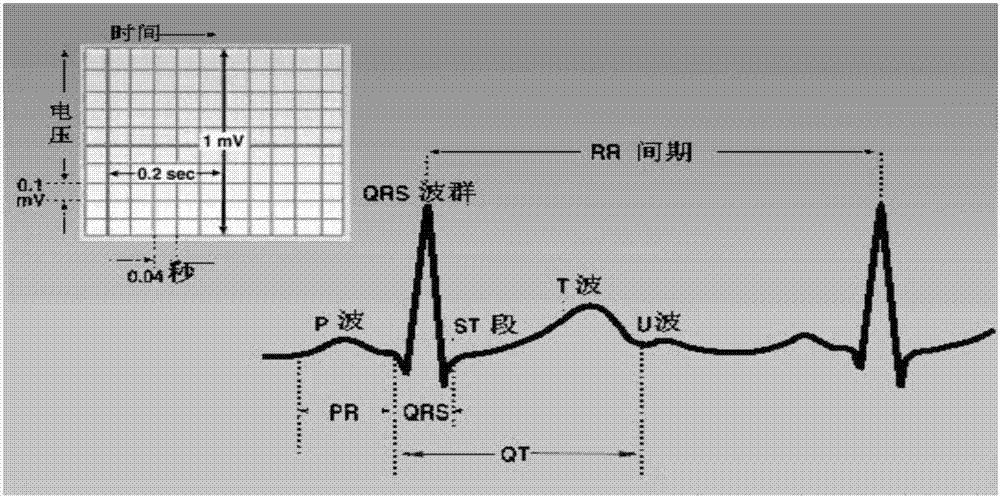 Electrocardiograph detection method based on multi-scale deep learning neural network