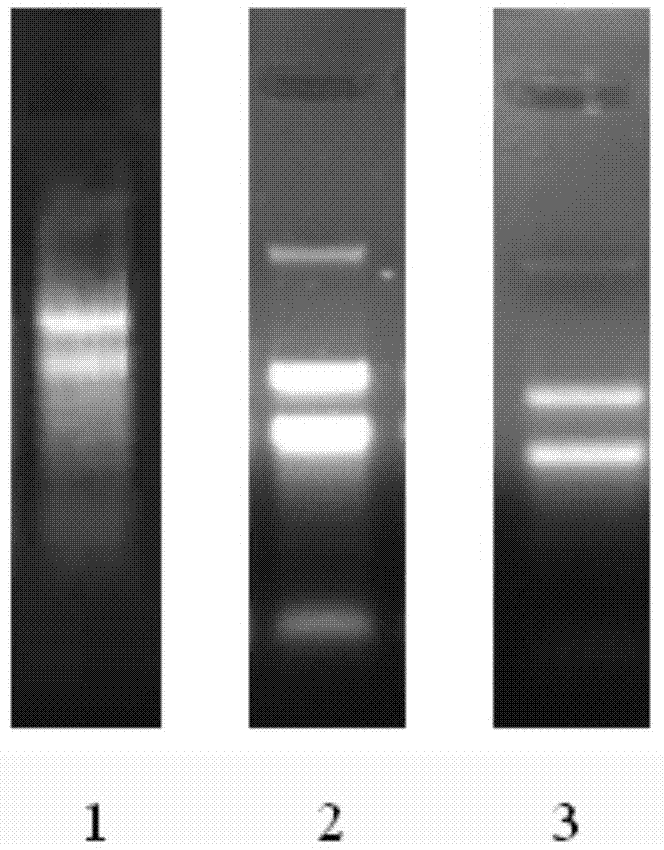 Extraction method for total RNA (Ribonucleic Acid) of apple tissues