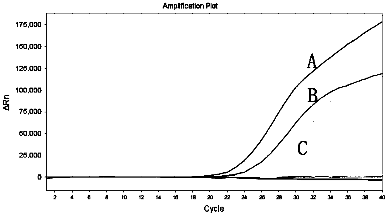 Multiple-fluorescence quantitative PCR primers, kit and detection method for detection of multiple types of bacteria