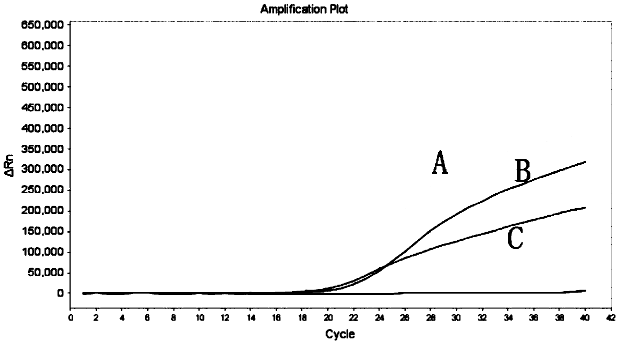 Multiple-fluorescence quantitative PCR primers, kit and detection method for detection of multiple types of bacteria