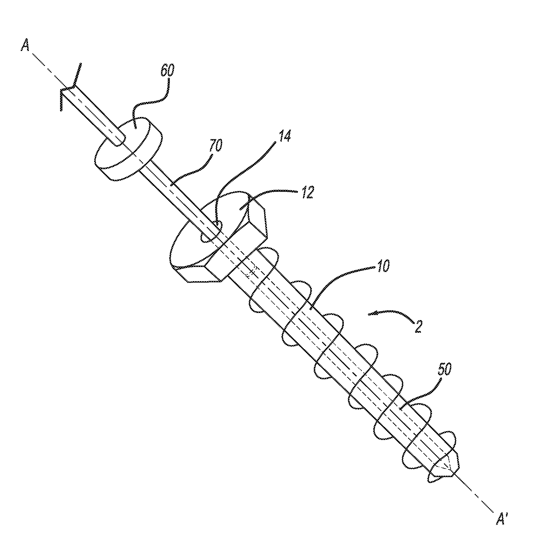 Retractable screw guide