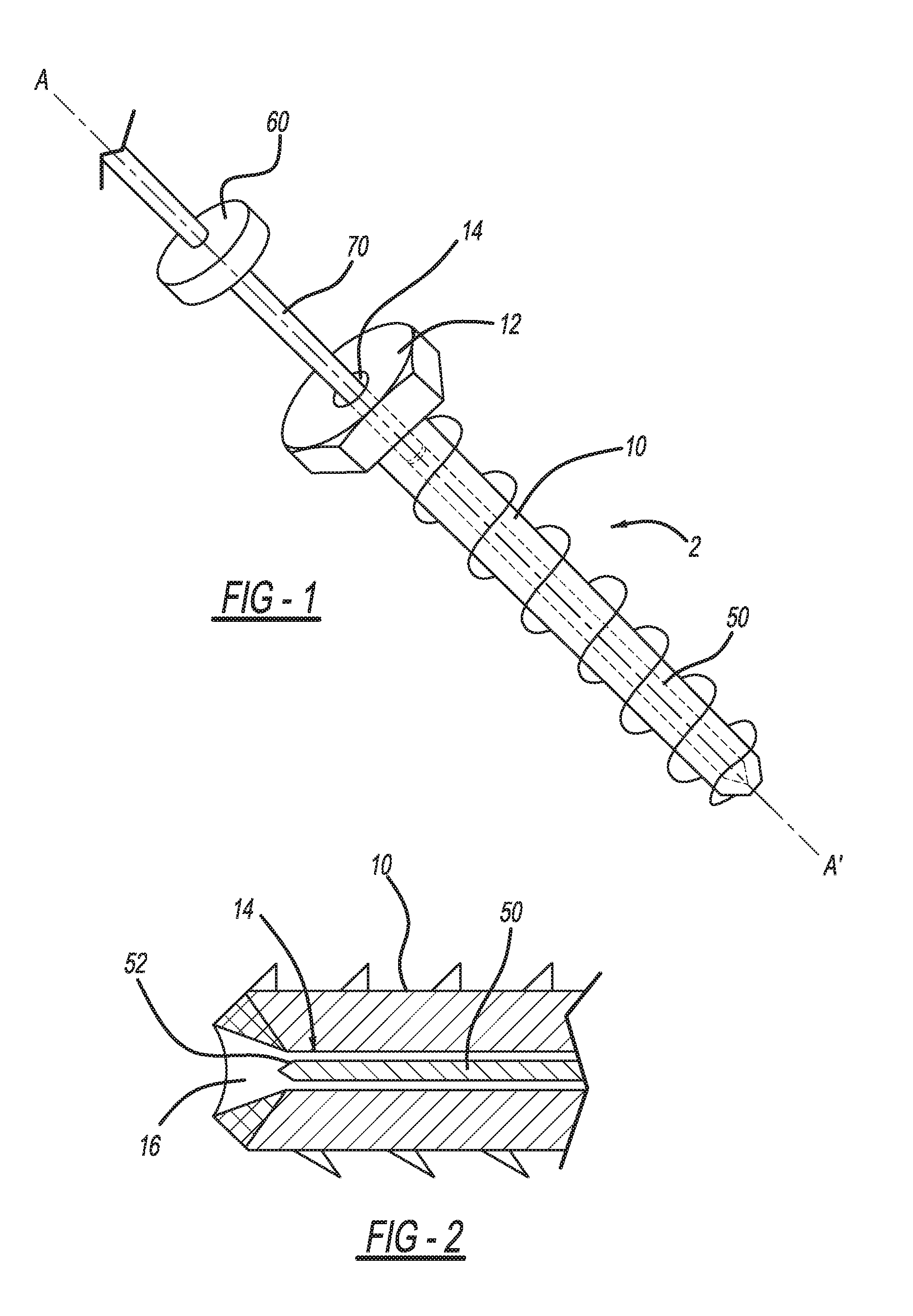 Retractable screw guide