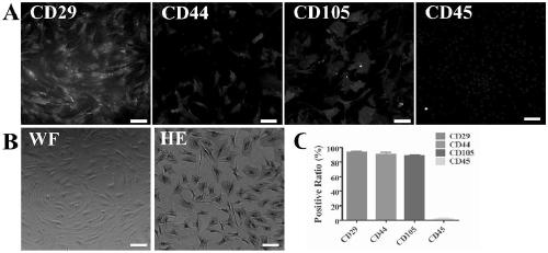 Neuronal precursor cells derived from adipose-derived stem cells and preparation method and application of neuronal precursor cells