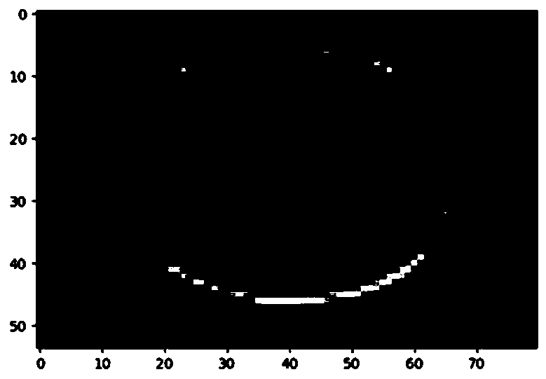 B-mode ultrasound image fetus head circumference detection method based on closed-loop shortest path