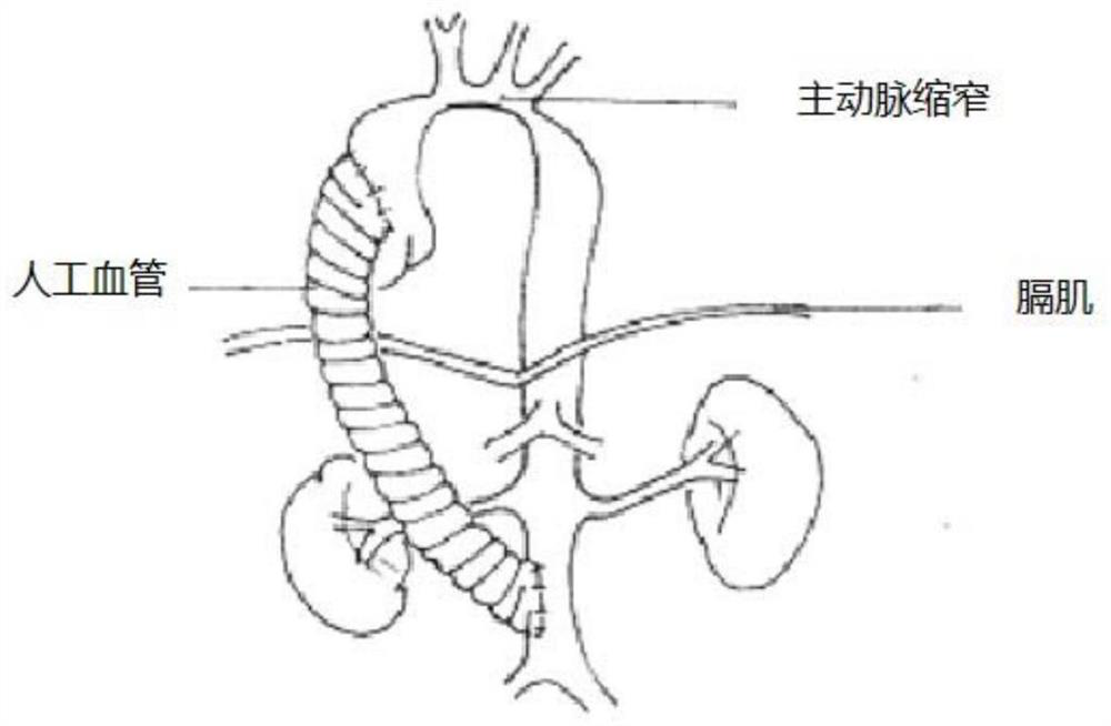 Cardiac bypass mode selection system