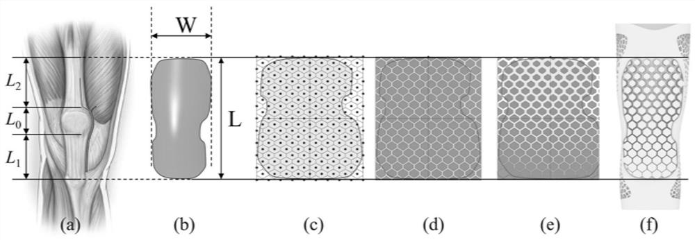 In-vitro orthopedic device and manufacturing method thereof