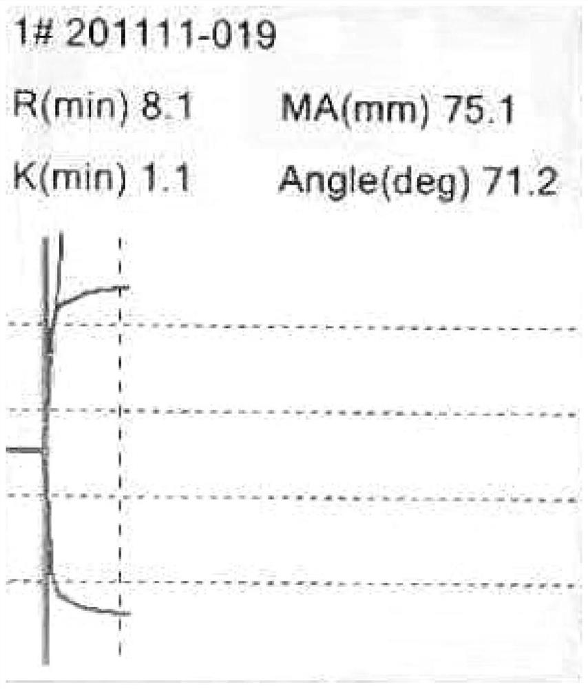 Preparation method and application of anticoagulant pig blood and pig plasma for thrombus test