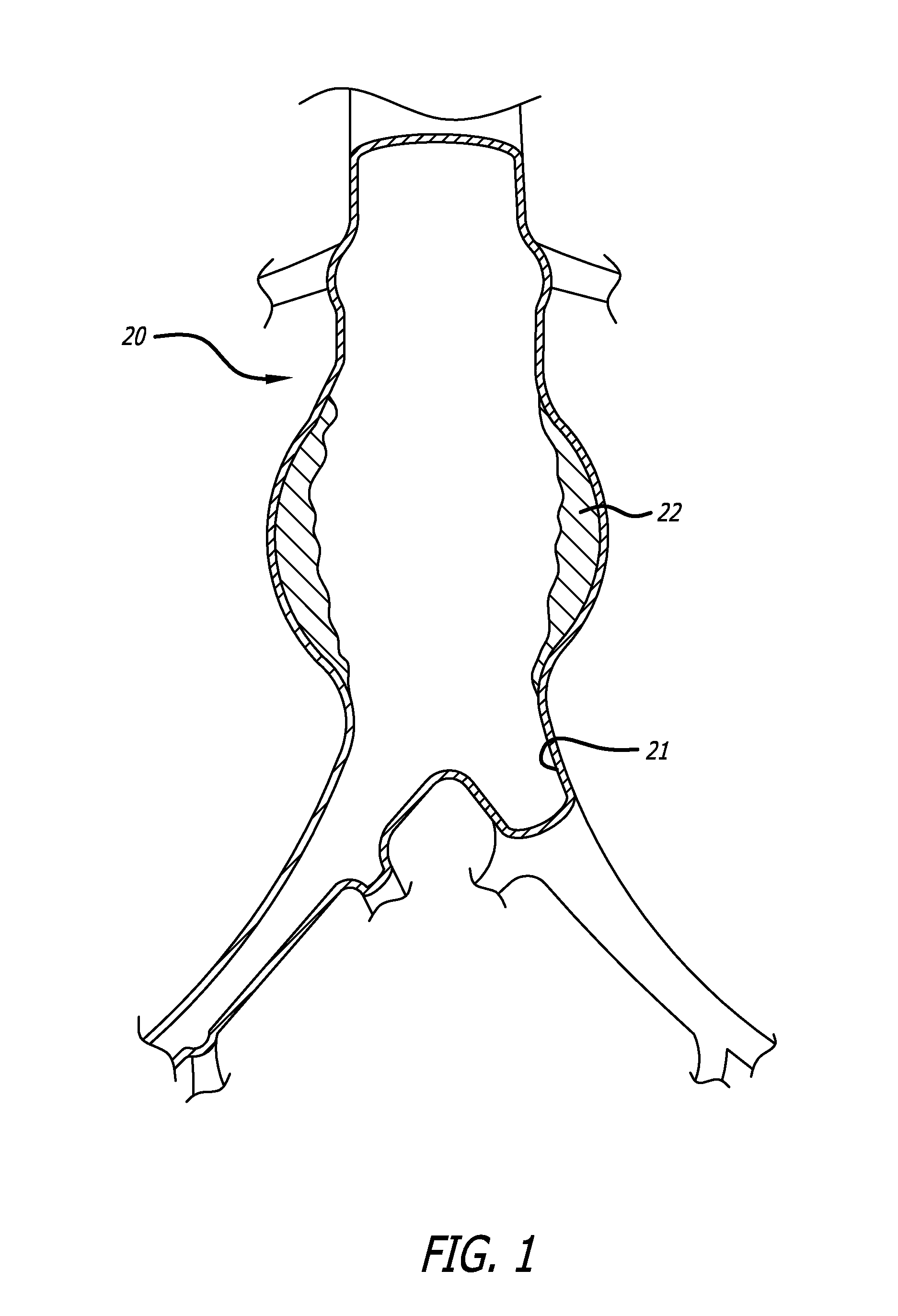 Methods and devices for aiding in situ assembly of repair devices