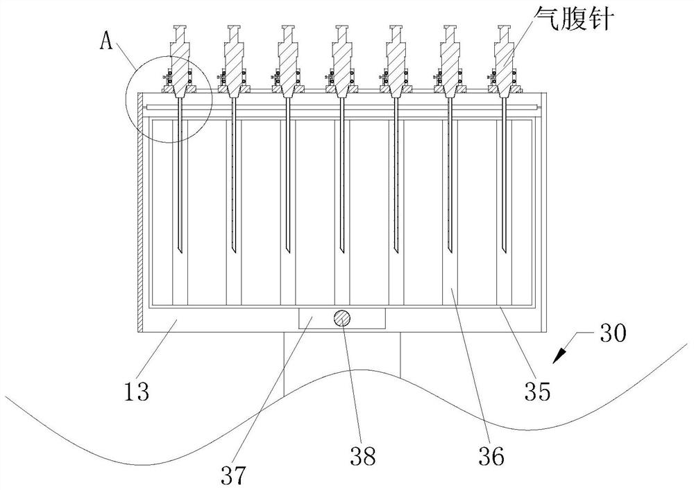 Medical pneumoperitoneum needle collecting and processing device