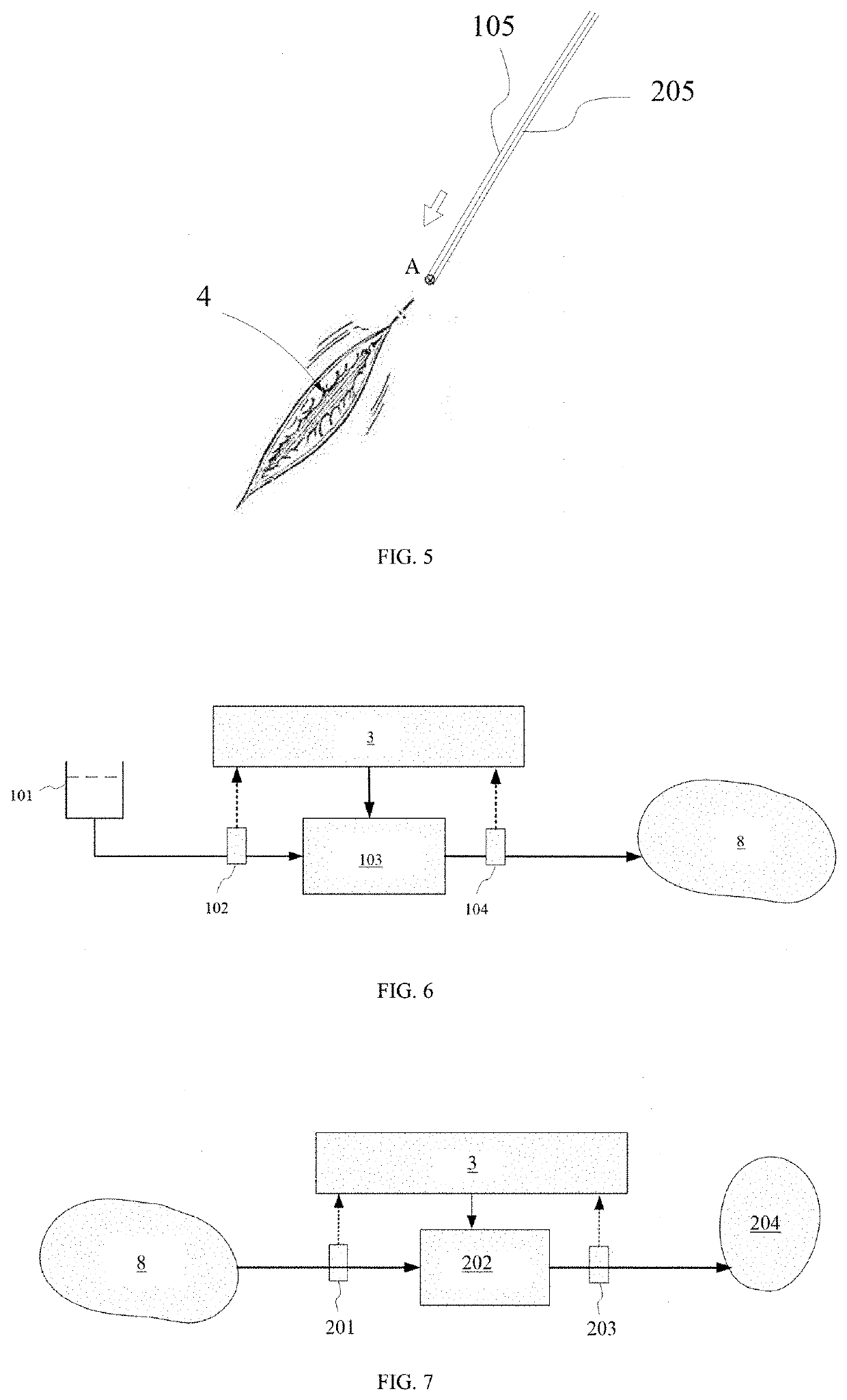 Negative pressure drainage and cleaning system for sutureless closed skin incisions