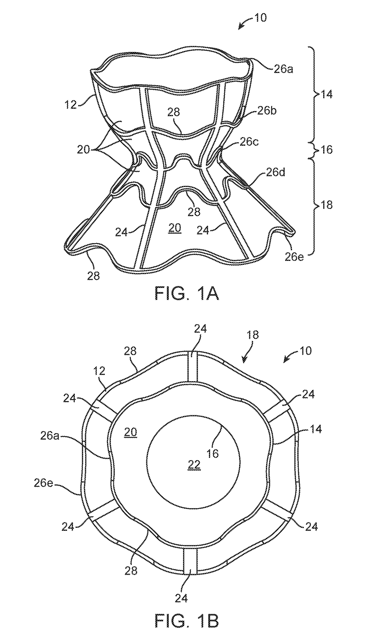 Shunt for redistributing atrial blood volume