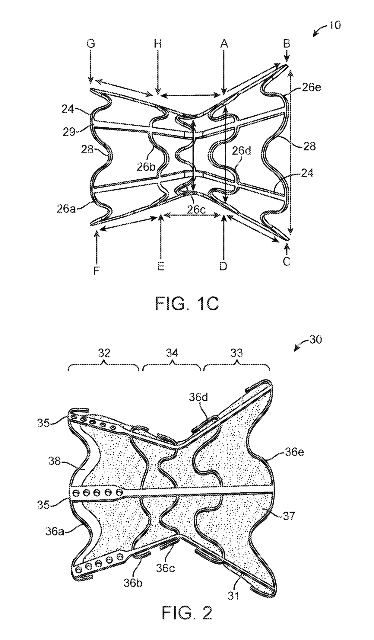 Shunt for redistributing atrial blood volume