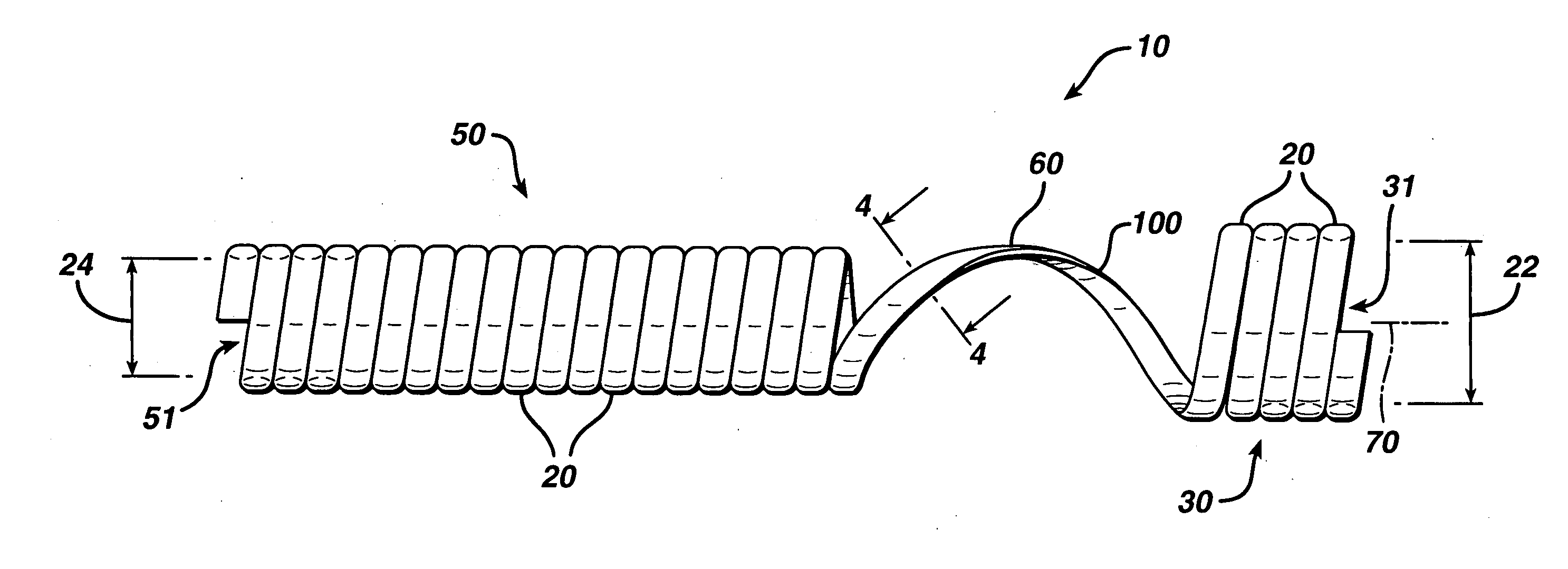 Biodegradable stent