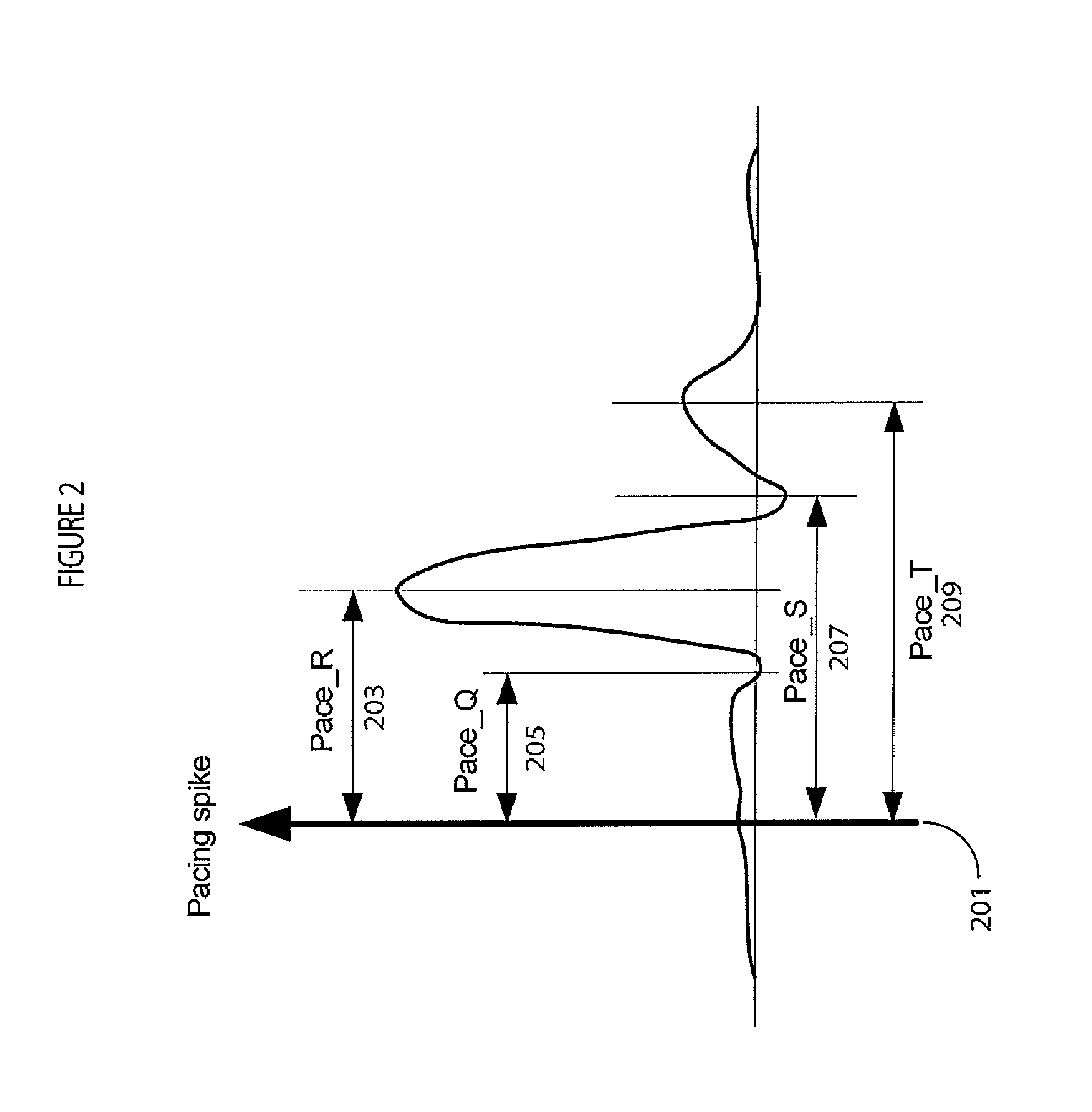 System for Cardiac Arrhythmia Detection