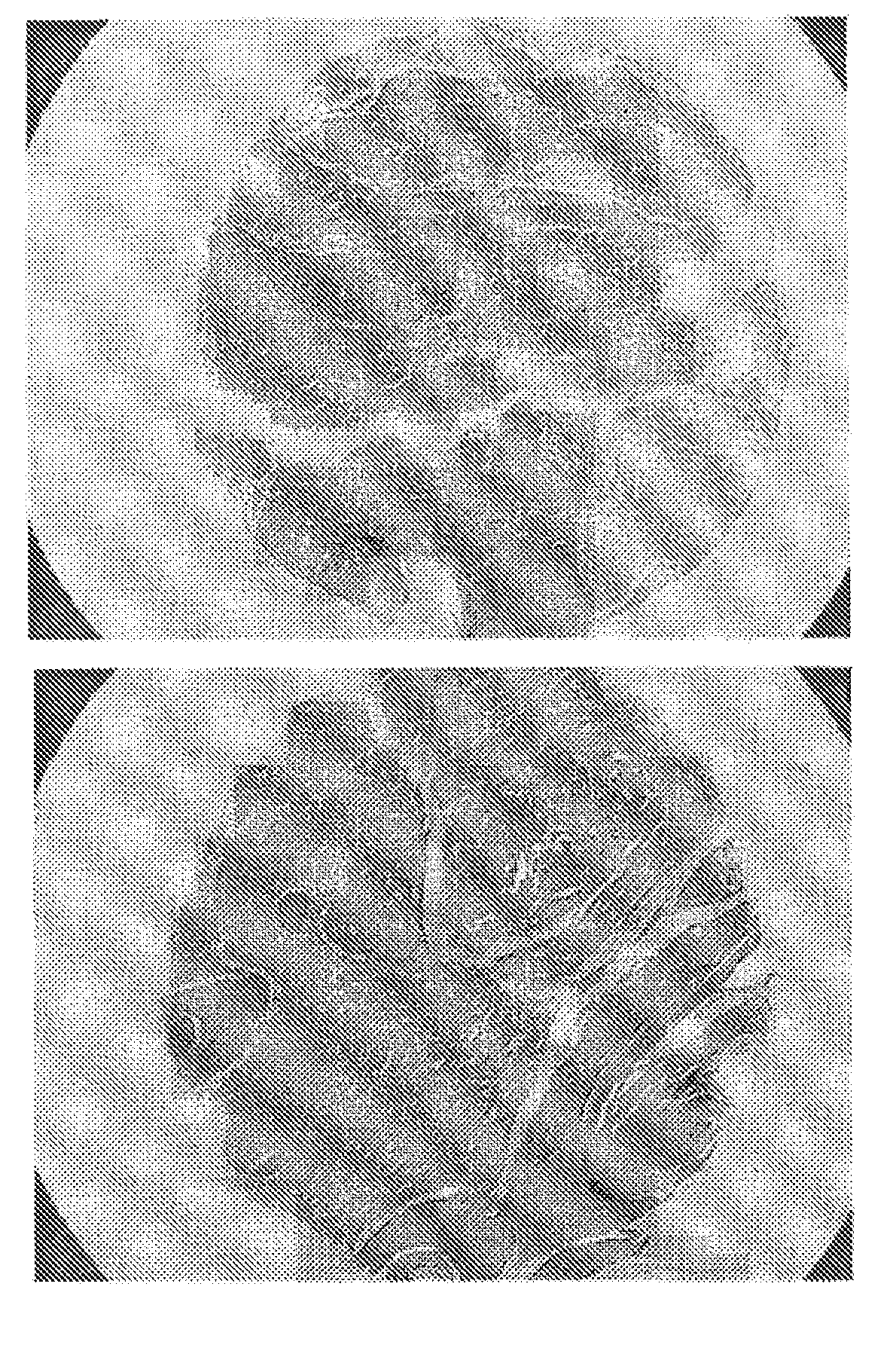 Diagnosis/Treatment Option for Head-and-Neck Tumor Using Micro-RNA as Biomarker