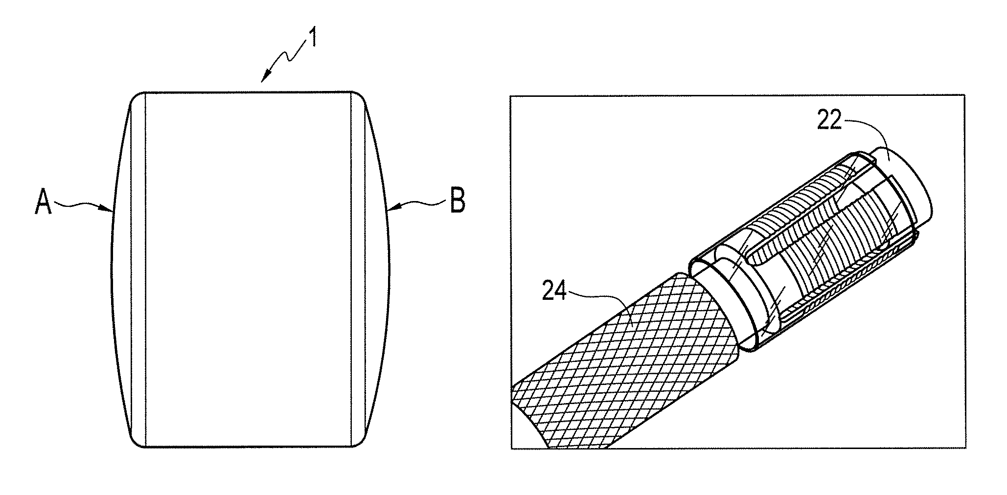 Method and instrumentation for osteochondral repair using preformed implants
