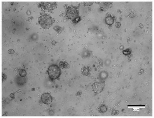 Culture medium and culture method for colorectal cancer organoids