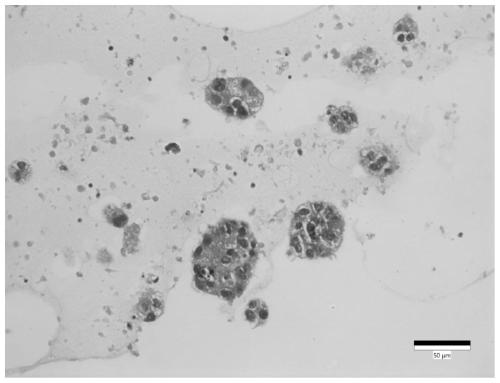 Culture medium and culture method for colorectal cancer organoids