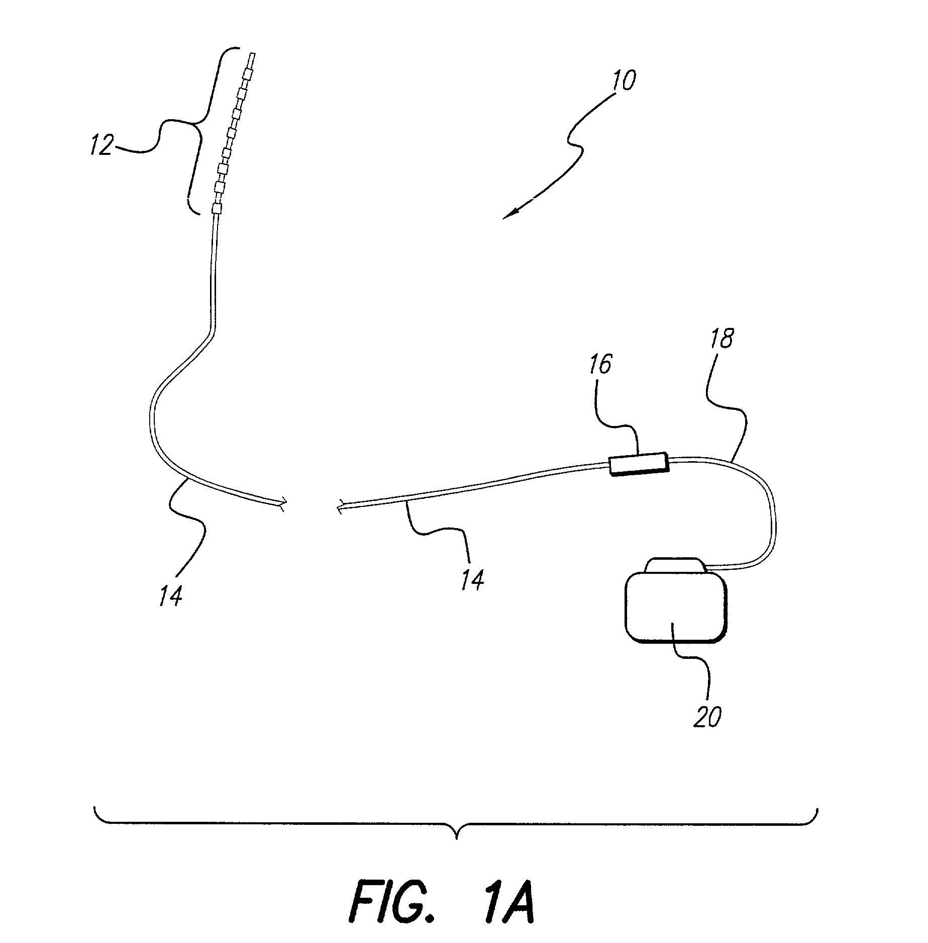 Multi-compliance voltage generator in a multichannel current stimulator