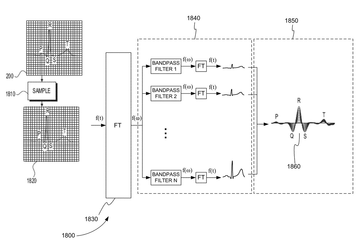 Automated ECG Analysis and Diagnosis System