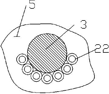 Nut protein extraction device with primary auxiliary teeth and feeding sensor