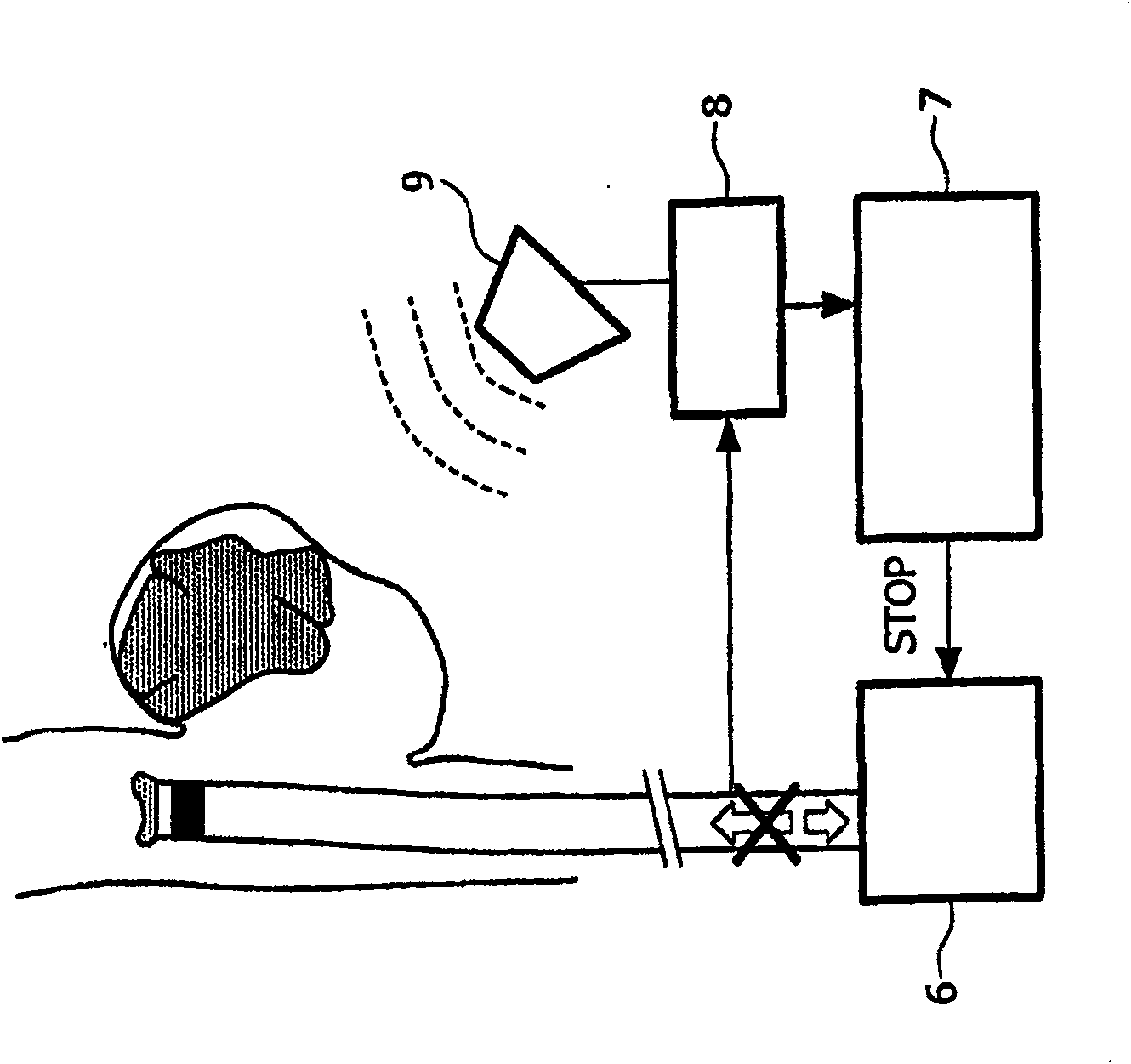 Catheter, apparatus and method for therapeutic embolization