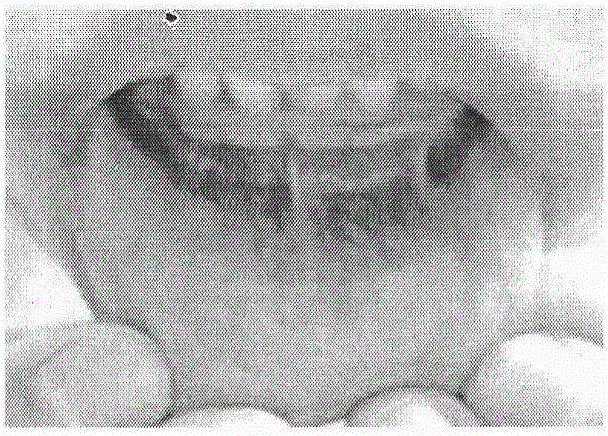 External-use traditional Chinese medicine compound preparation for treating recurrent oral ulceration and preparation method of external-use traditional Chinese medicine compound preparation