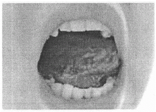 External-use traditional Chinese medicine compound preparation for treating recurrent oral ulceration and preparation method of external-use traditional Chinese medicine compound preparation